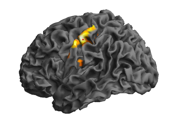 MRI 3D render